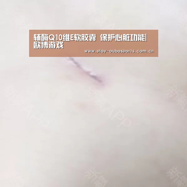 辅酶Q10维E软胶囊 保护心脏功能|欧博游戏(图1) 欧博游戏